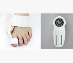 Hallux Valgus Corrector With Foot Valgus Separator - Chubbbys World